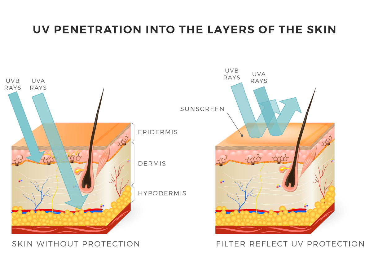 Воздействие солнечных лучей на кожу